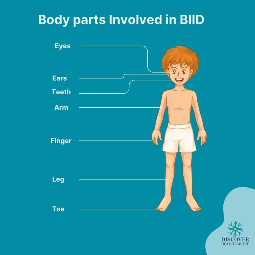 How is Body Integrity Identity Disorder (BIID) Diagnosed?